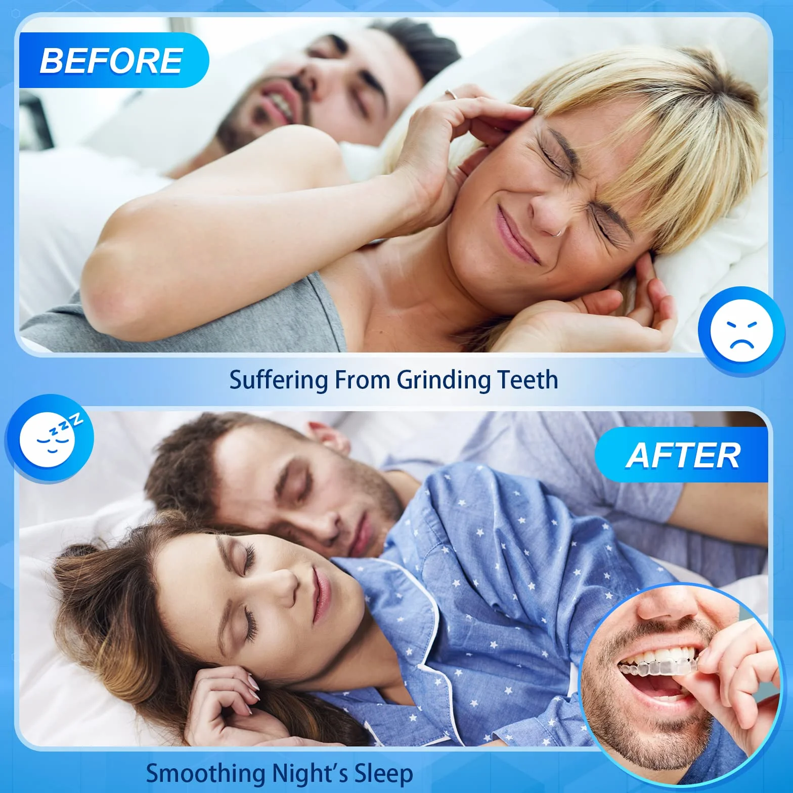 Kit de Protección Dental 4Pcs, Férula Descarga Bruxismo, Protector Bucal Para Dormir, Material Termoplástico