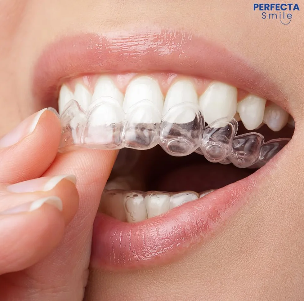 Boston Tech 10 Férulas Dentales para Bruxismo Nocturno Protector Bucal Sin BPA Estuche Incluido