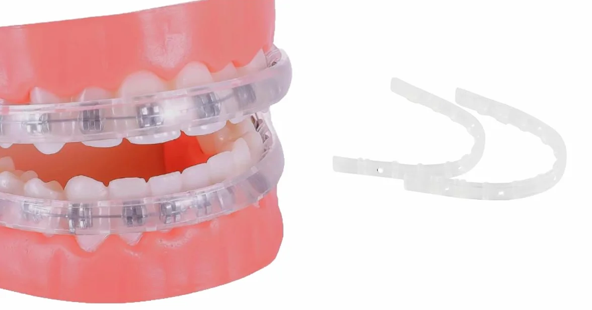 Protector de labios para brackets, funda ortodóntica cómoda alternativa a la cera